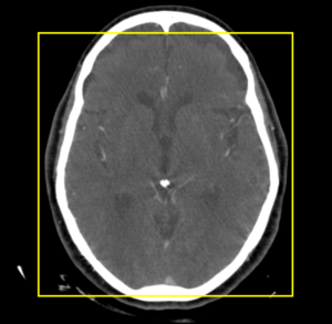 RadPix Capture Usage - RadPix Radiology Teaching File Software